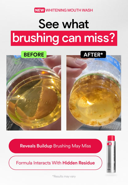 Buy 2 Get 1 Free - iD Stain Whitening Mouthwash