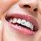 SmileStika Flower Pack