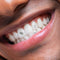 SmileStika Mixed Gem Pack